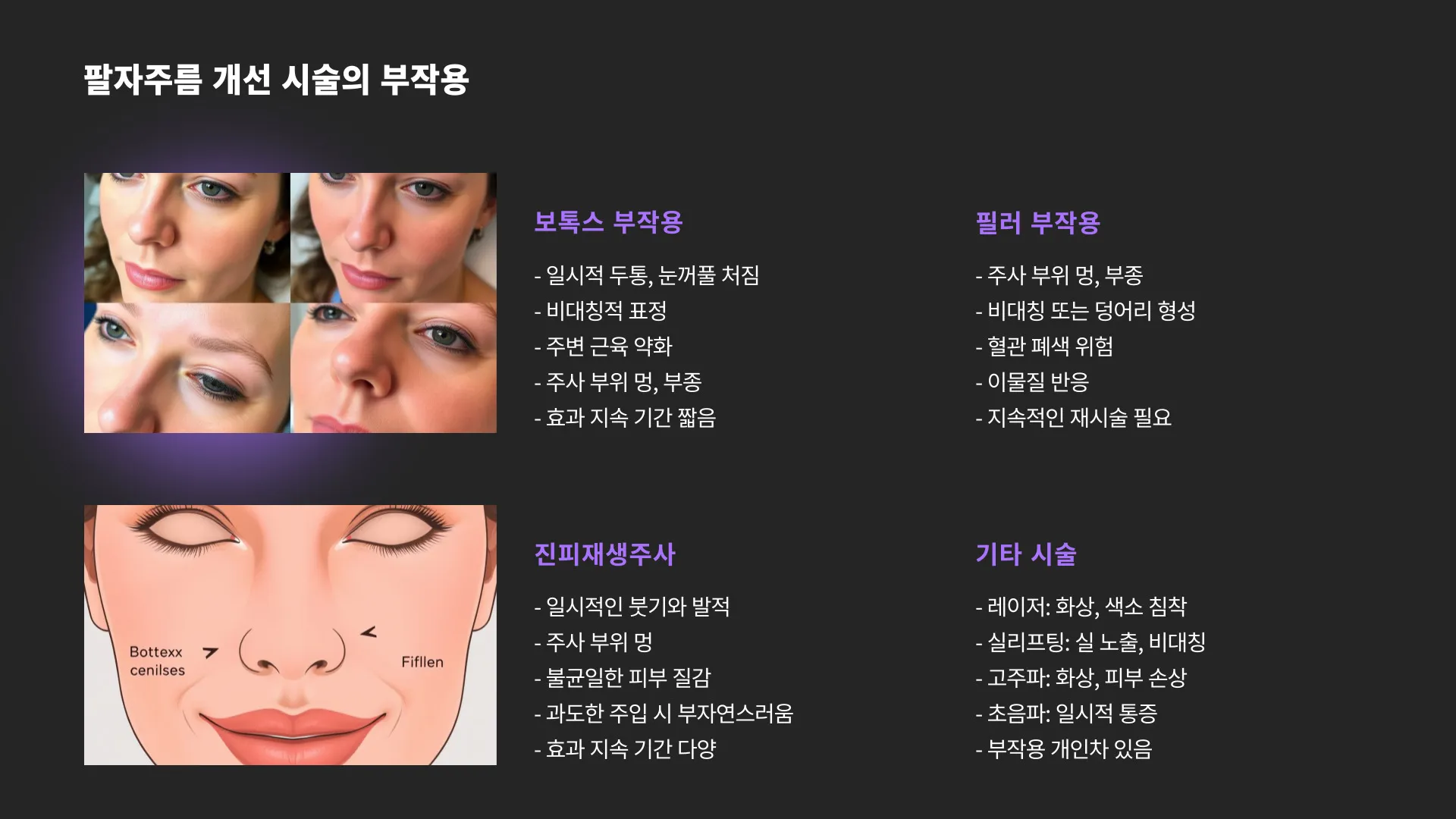 팔자주름 보톡스 필러 이미지 9